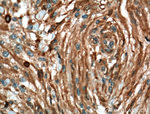 MGEA5 Antibody in Immunohistochemistry (Paraffin) (IHC (P))