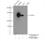 MGEA5 Antibody in Immunoprecipitation (IP)