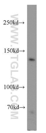 MGEA5 Antibody in Western Blot (WB)