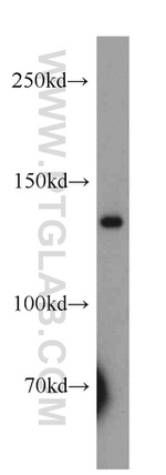 MGEA5 Antibody in Western Blot (WB)