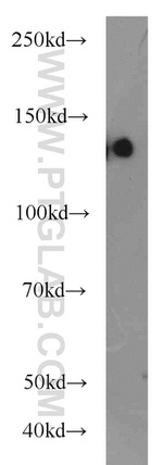 MGEA5 Antibody in Western Blot (WB)