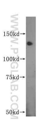 MGEA5 Antibody in Western Blot (WB)