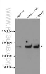 MGEA5 Antibody in Western Blot (WB)