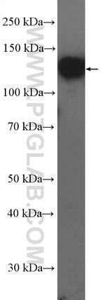 MGEA5 Antibody in Western Blot (WB)