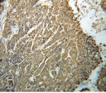 ERp72 Antibody in Immunohistochemistry (Paraffin) (IHC (P))