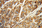 ERp72 Antibody in Immunohistochemistry (Paraffin) (IHC (P))