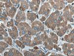 ERp72 Antibody in Immunohistochemistry (Paraffin) (IHC (P))