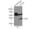 PEX19 Antibody in Immunoprecipitation (IP)