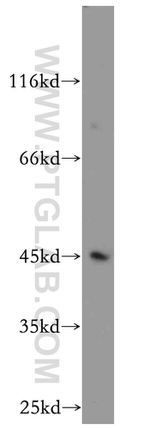 KLF6 Antibody in Western Blot (WB)