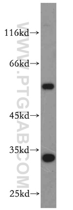 KLF6 Antibody in Western Blot (WB)