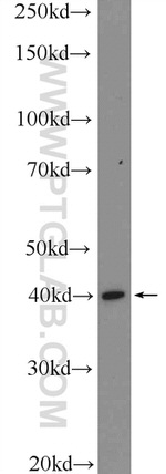 KLF6 Antibody in Western Blot (WB)