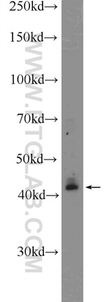 KLF6 Antibody in Western Blot (WB)