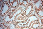 CNBP Antibody in Immunohistochemistry (Paraffin) (IHC (P))