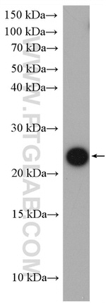 CNBP Antibody in Western Blot (WB)