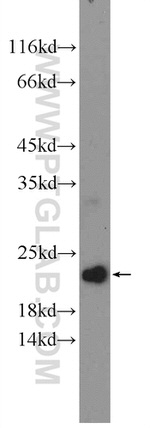 CNBP Antibody in Western Blot (WB)
