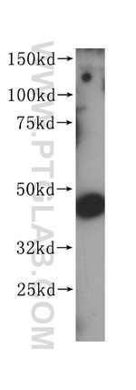 PGD Antibody in Western Blot (WB)