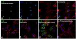 IL-8 (1-77) (CXCL8) Antibody in Immunocytochemistry (ICC/IF)