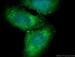 PHGDH Antibody in Immunocytochemistry (ICC/IF)