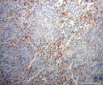 PHGDH Antibody in Immunohistochemistry (Paraffin) (IHC (P))