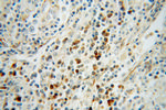 PHGDH Antibody in Immunohistochemistry (Paraffin) (IHC (P))