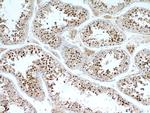 SPAG5 Antibody in Immunohistochemistry (Paraffin) (IHC (P))