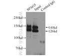 SPAG5 Antibody in Immunoprecipitation (IP)