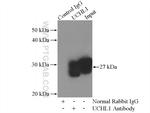 UCHL1/PGP9.5 Antibody in Immunoprecipitation (IP)