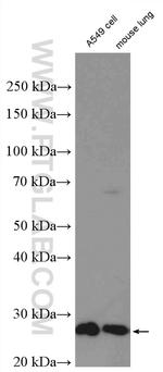 UCHL1/PGP9.5 Antibody in Western Blot (WB)