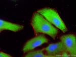 UCHL1/PGP9.5 Antibody in Immunocytochemistry (ICC/IF)