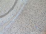 UCHL1/PGP9.5 Antibody in Immunohistochemistry (Paraffin) (IHC (P))