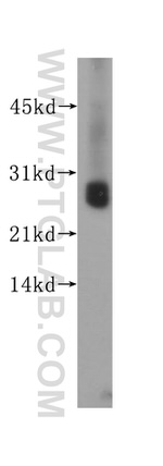 UCHL1/PGP9.5 Antibody in Western Blot (WB)