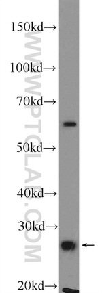 UCHL1/PGP9.5 Antibody in Western Blot (WB)