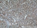 CYP27A1 Antibody in Immunohistochemistry (Paraffin) (IHC (P))