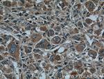 CYP27A1 Antibody in Immunohistochemistry (Paraffin) (IHC (P))