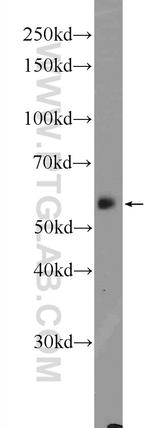 CYP27A1 Antibody in Western Blot (WB)