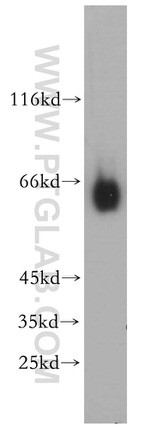 CYP27A1 Antibody in Western Blot (WB)