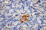 CDK5RAP1 Antibody in Immunohistochemistry (Paraffin) (IHC (P))