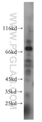 CDK5RAP1 Antibody in Western Blot (WB)