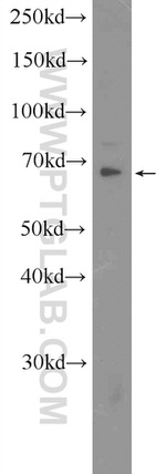 CDK5RAP1 Antibody in Western Blot (WB)