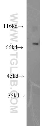 CDK5RAP1 Antibody in Western Blot (WB)