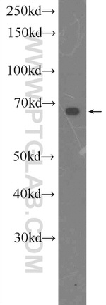 CDK5RAP1 Antibody in Western Blot (WB)