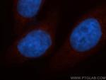 UQCRC2 Antibody in Immunocytochemistry (ICC/IF)