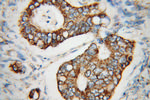 UQCRC2 Antibody in Immunohistochemistry (Paraffin) (IHC (P))