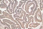 UQCRC2 Antibody in Immunohistochemistry (Paraffin) (IHC (P))