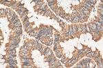 UQCRC2 Antibody in Immunohistochemistry (Paraffin) (IHC (P))