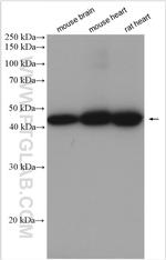 UQCRC2 Antibody in Western Blot (WB)