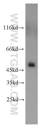 UQCRC2 Antibody in Western Blot (WB)