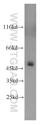 UQCRC2 Antibody in Western Blot (WB)