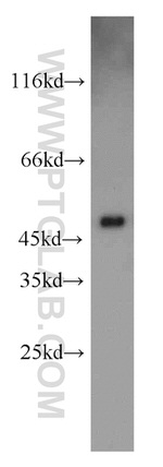 UQCRC2 Antibody in Western Blot (WB)