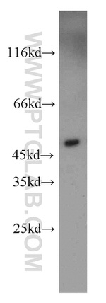 UQCRC2 Antibody in Western Blot (WB)